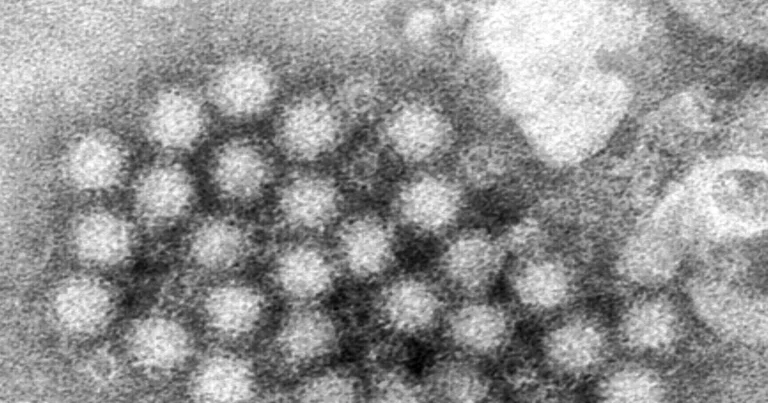Norovirus Cases Are Surging in Parts of US, CDC Data Shows