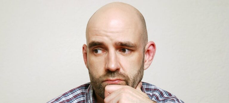 Male Pattern Baldness: Everything You Need To Know