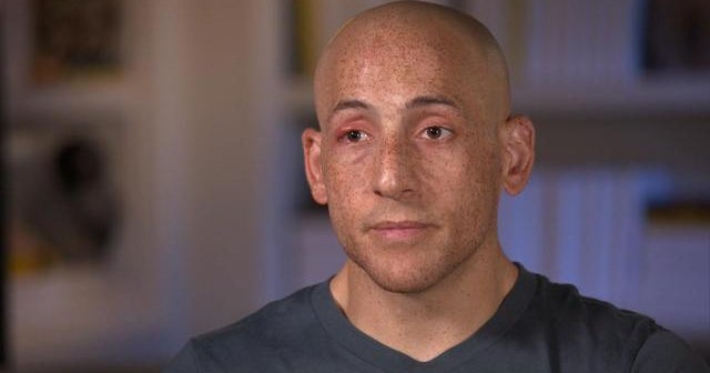 How caring letters prevent suicide