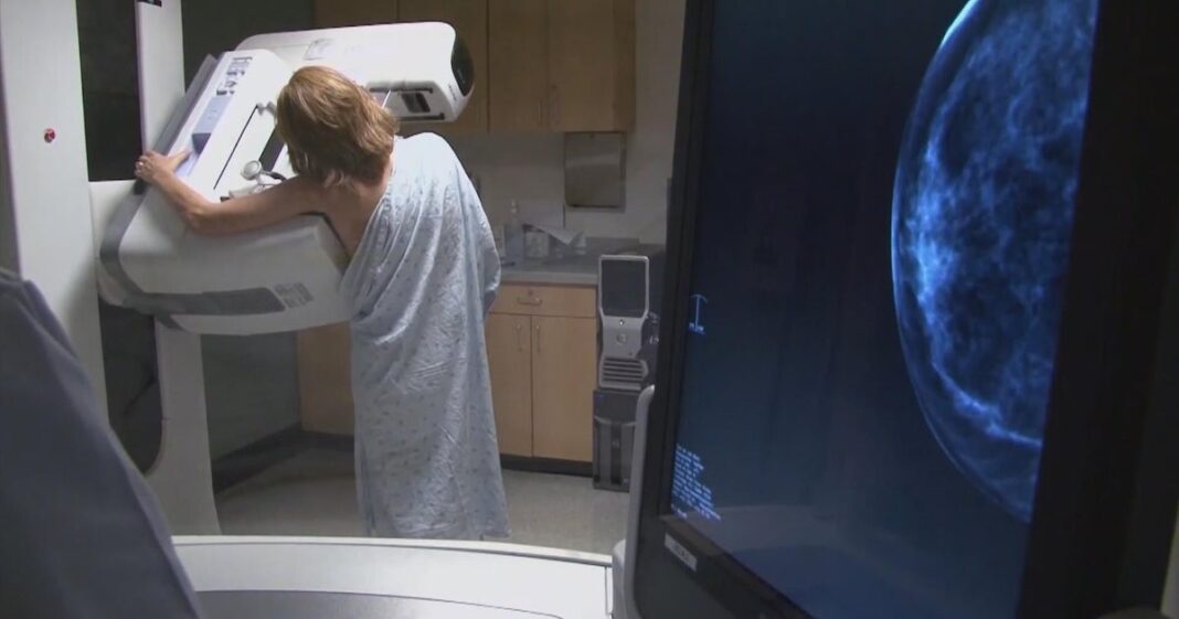 Cost of mammograms: Preventative breast exams leave women with unexpected bills