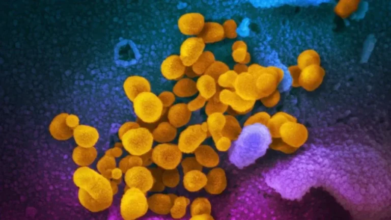 New COVID-19 Variant ‘Stratus’ Emerges, Rises to 3rd-Most Prevalent in US