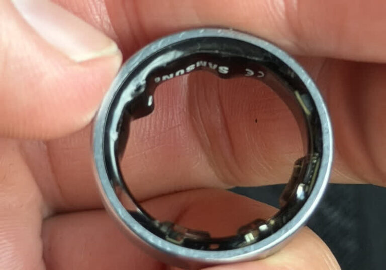 Samsung Galaxy Ring swells and crushes user's finger, causing missed flight and hospital visit