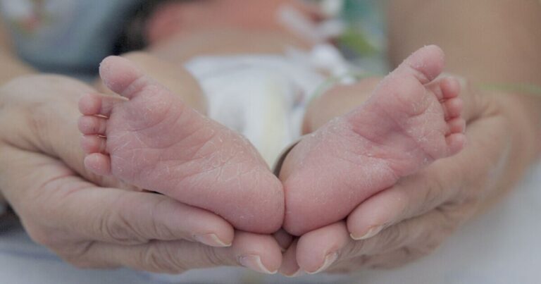 Mystery solved 35 years after doctors accidentally muddled up newborns | World | News