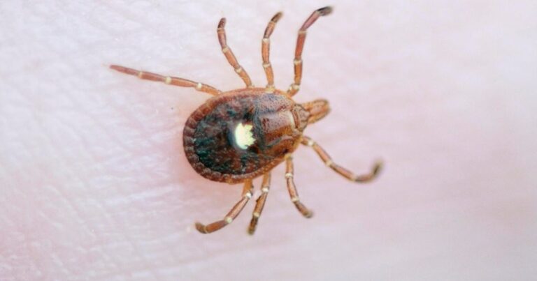 1st death linked to alpha-gal syndrome, a meat allergy spread by ticks, reported in N.J., researchers say
