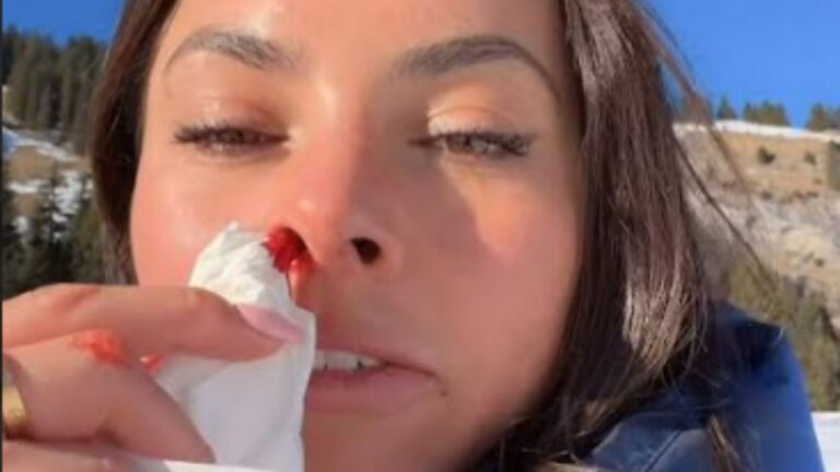 Watch terrifying moment Love Island’s Paige is smashed in the face after snowboarding accident
