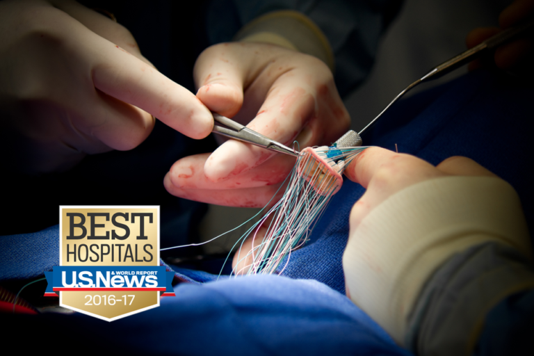 What to Know Before Undergoing Heart Valve Replacement Surgery