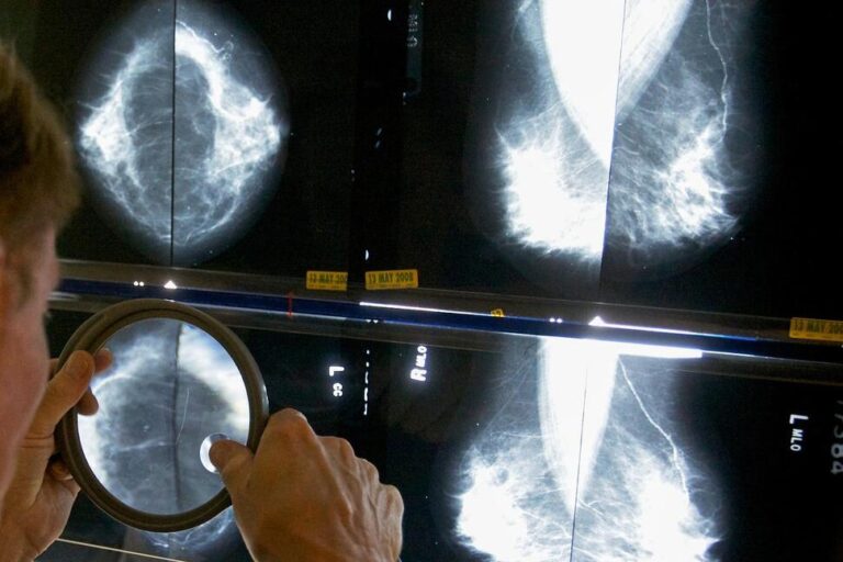 Pandemic Disruptions to Health Care Worsened Cancer Survival, Study Suggests
