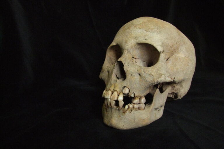 Ancient Teeth From Siberia Rewrite the Plague’s Timeline, Dating Back to Over 5,500 Years Ago