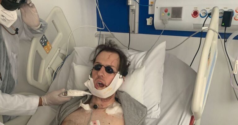 Man has his jaw rebuilt with leg bone after horror fall chasing thief | World | News